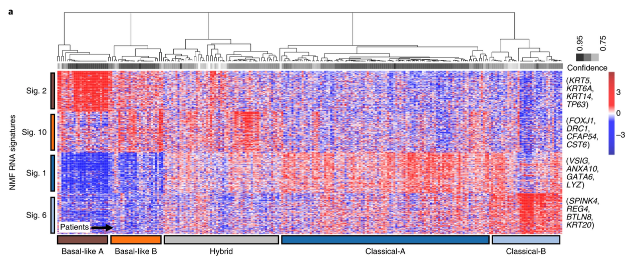 PDAC subtypes