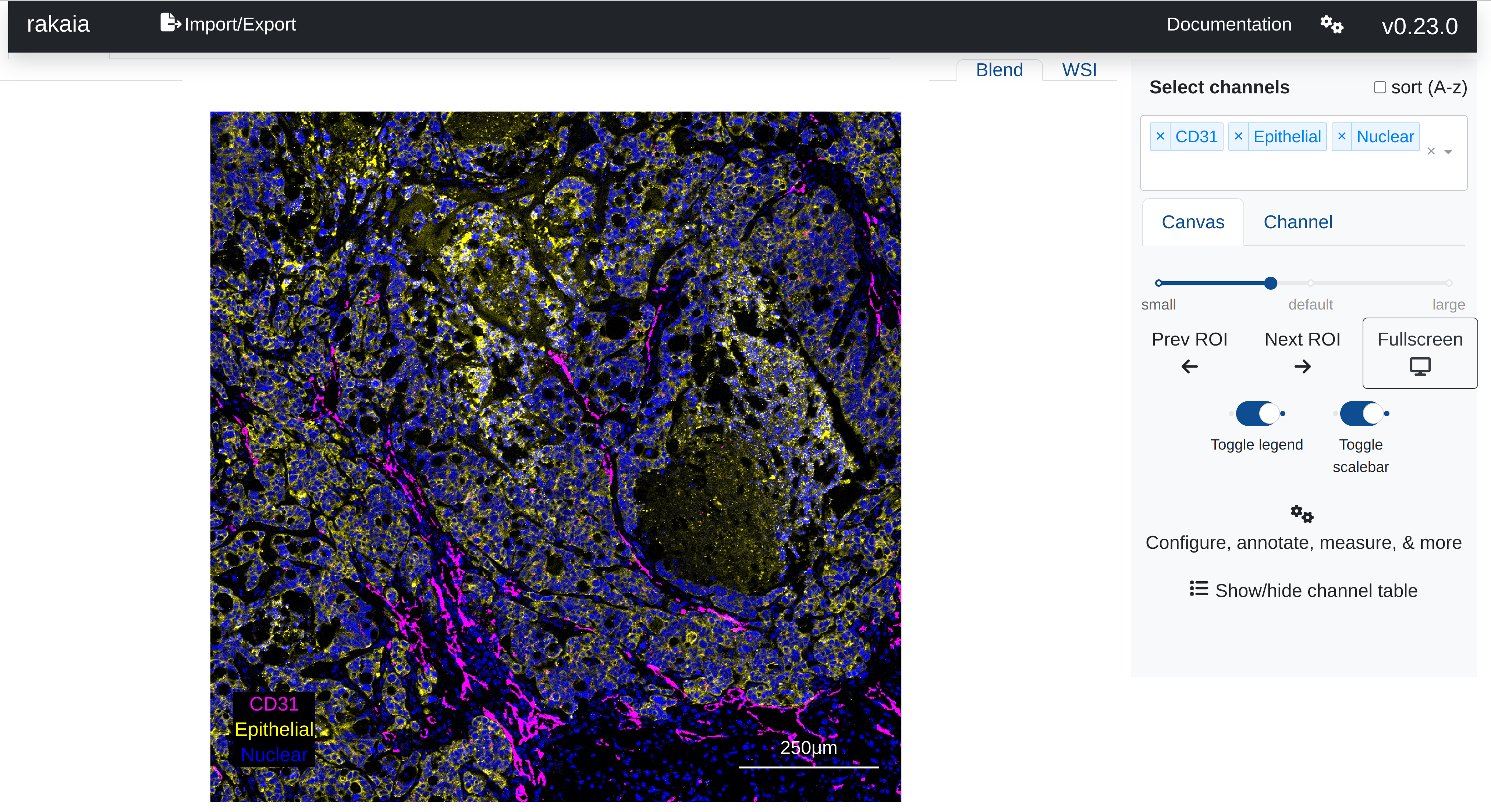Use drag and drop or local directory import to load and  analyze a wide variety of imaging datasets seamlessly in the browser.